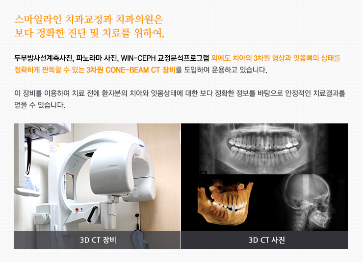 스마일라인치과는 보다 정확한 진단 및 치료를 위하여,두부방사선계측사진, 파노라마 사진, Win-Ceph 교정분석프로그램 외에도 치아의 3차원 형상과 잇몸뼈의 상태를 정확하게 판독할 수 있는 3차원 cone-beam CT 장비를 도입하여 운용하고 있습니다.이 장비를 이용하여 치료 전에 환자분의 치아와 잇몸상태에 대한 보다 정확한 정보를 바탕으로 안정적인 치료결과를 얻을 수 있습니다.