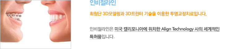 인비절라인 최첨단 3D모델링과 3D프린터 기술을 이용한 투명교정치료입니다.
인비절라인은 미국 캘리포니아에 위치한 Align Technology 사의 세계적인 특허품입니다. 